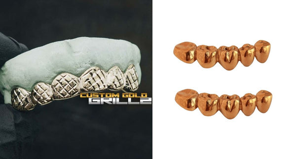 Understanding Grillz and Dentures