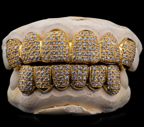 SOLID GOLD NATURAL DIAMOND GRILLZ