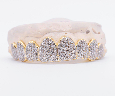 Yellow Gold with Diamond Grillz