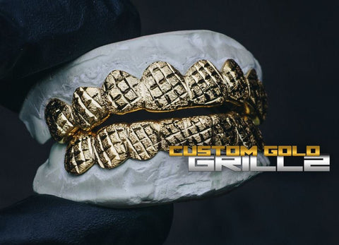 Custom Gold Grillz: How Long Does it Take?