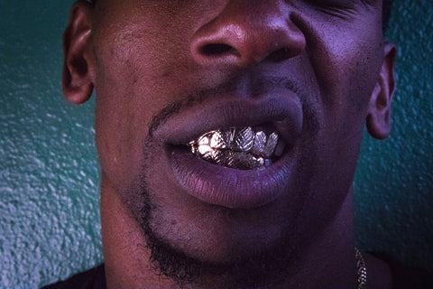 Experience Grillz on Dentures