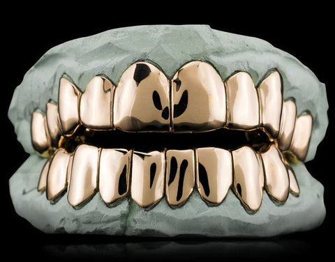 SOLID GOLD GRILLZ