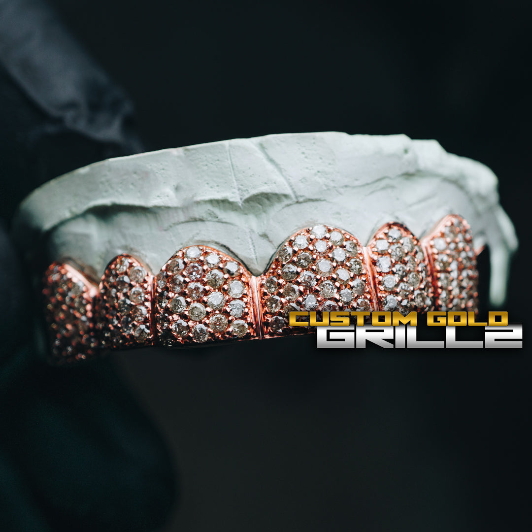 DIY Tooth Gemz Kit - Custom Gold Grillz