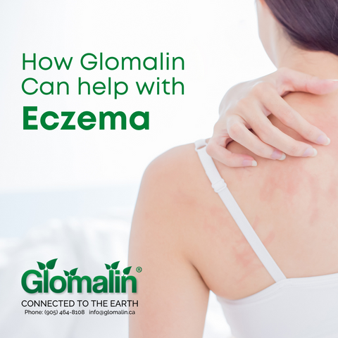 How Glomalin Can Help With Eczema