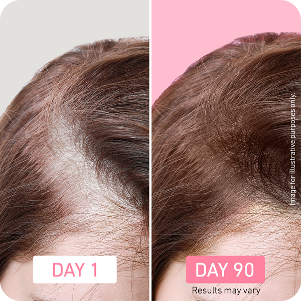 BOLDIFY Hair Boost Serum Results