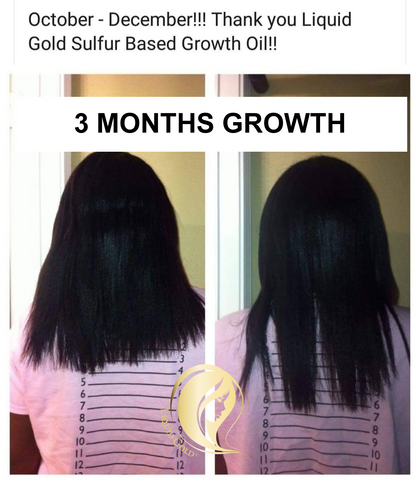 Hair Growth Oil - Liquid Gold Sulfur