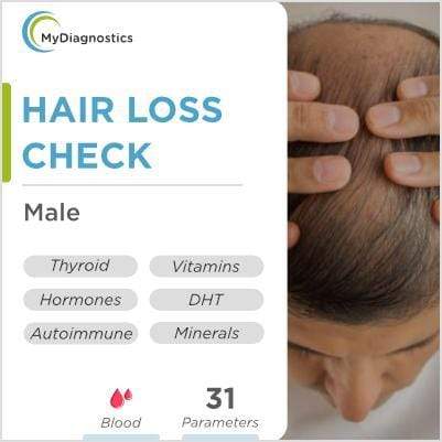 Trichos  DHT Hormone  Hairloss Causes