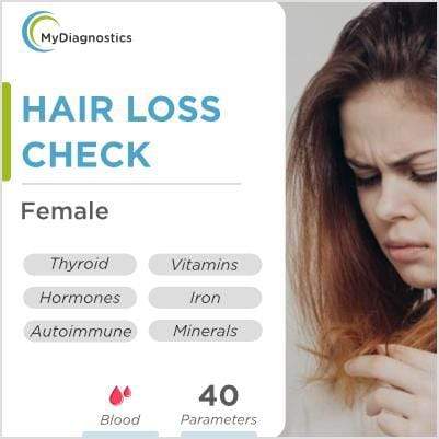 5 Types of Hair Loss Patterns in Females and Reversible Treatment  Bee  Choo Ladies