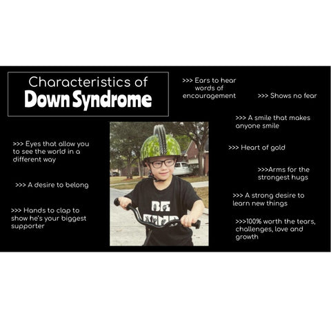 Down+syndrome+characteristics