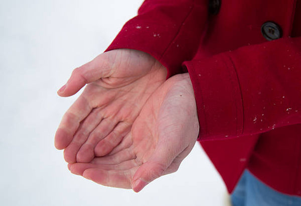 Raynaud's sufferers struggle to keep hands warm