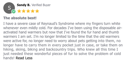 Customer Review of fur-based thumb warmers - Best Alternative Product to Raynaud's Gloves