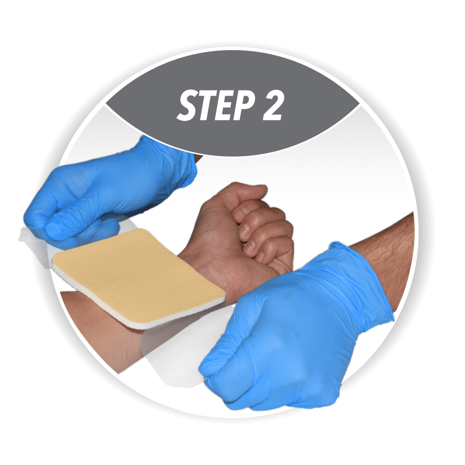 alginate calcium dressings abena step2