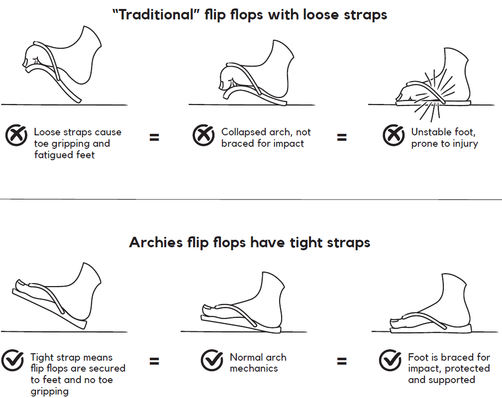 flip flop straps too loose
