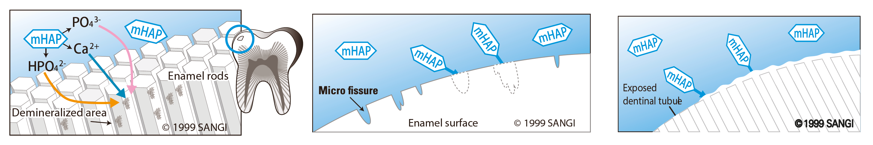 Demineralization