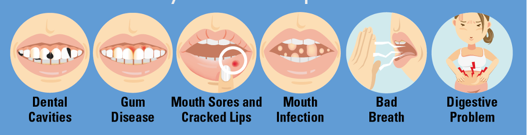 Dry mouth impacts