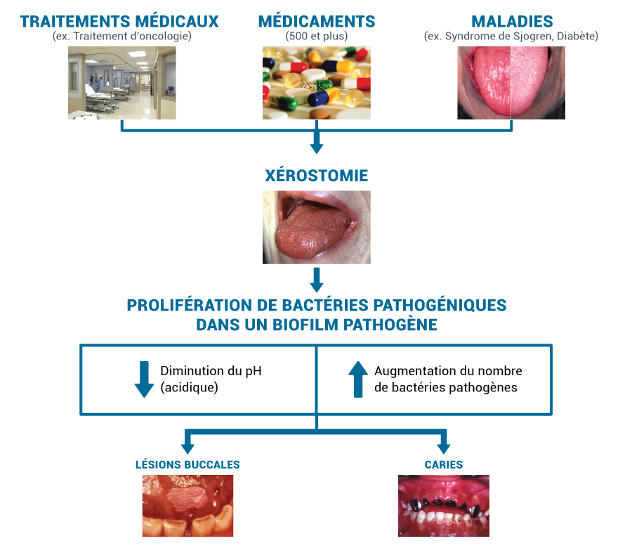 lesions-graph-fr_e02826fc-ce77-4417-8347-f74dcc0b5502.png