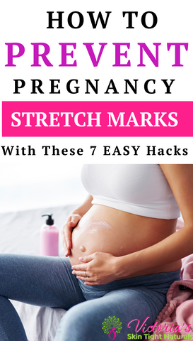 7 Ways To Prevent Stretch Marks for New Moms