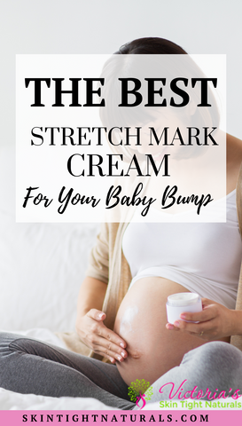 7 Ways To Prevent Stretch Marks for New Moms