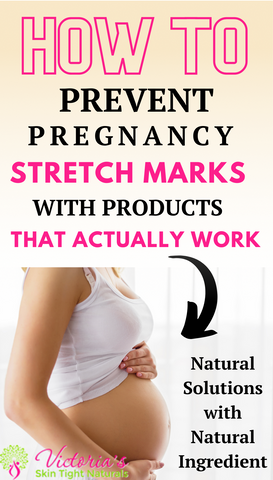 7 Ways To Prevent Stretch Marks for New Moms