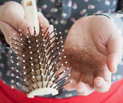 Women losing hair