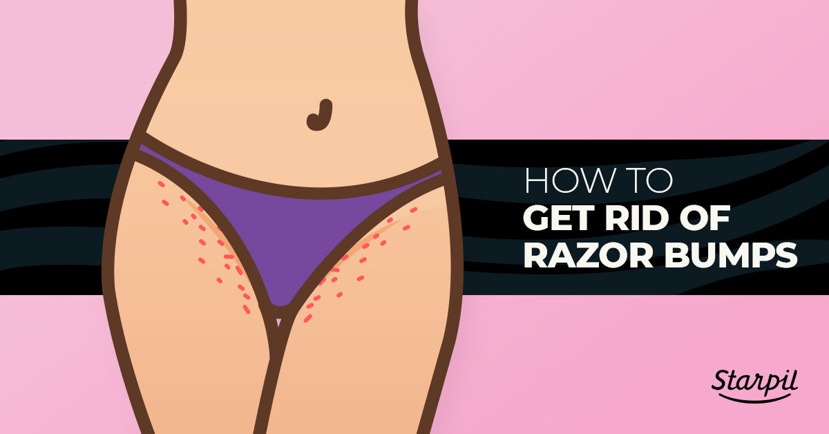 How to Get Rid of Razor Bumps for Good | Starpil Wax