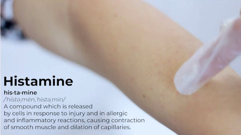 what is histamine?