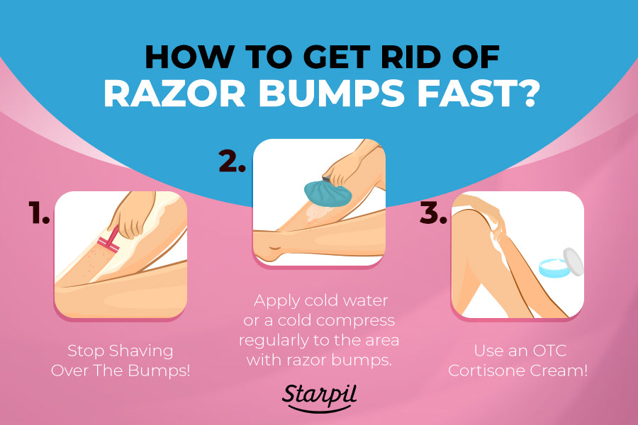 How to Get Rid of Razor Bumps for Good | Starpil Wax