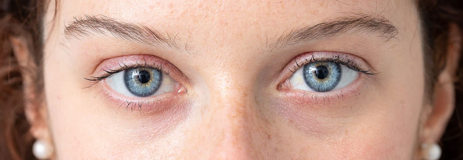 close up image of healthy blue eyes