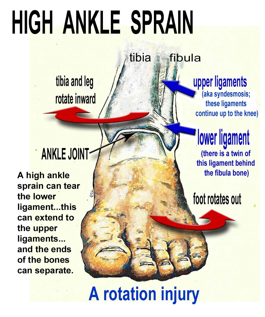 Ankle Sprains Causes, Symptoms, And Treatment EndurElite