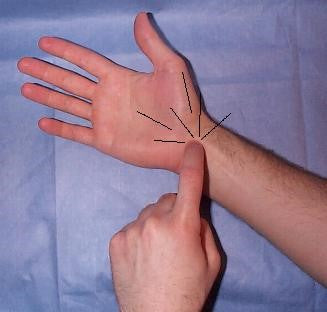 Carpal Tunnel Syndrome: Causes, Symptoms & Treatment