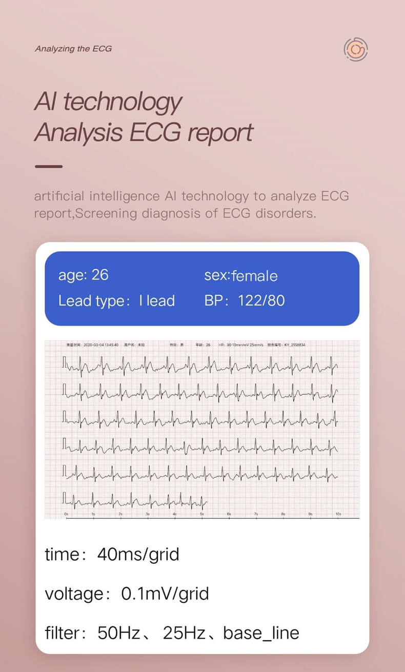 Findtime Smart Watch para mujeres ECG Presión arterial Oxígeno sanguíneo Monitor de frecuencia cardíaca