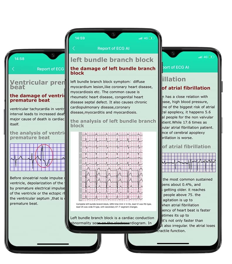 Findtime EKG-Smartwatch mit Blutdruckmessgerät, Körpertemperatur, Herzfrequenz, Blutsauerstoff