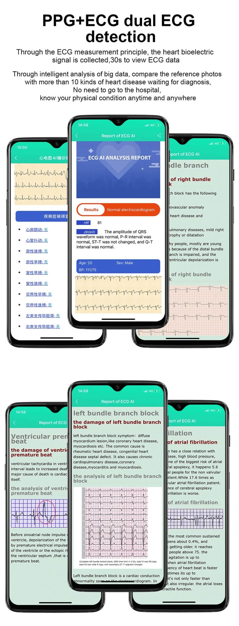 Findtime ECG Reloj inteligente Monitor Presión arterial Ritmo cardíaco Oxígeno en sangre Temperatura corporal