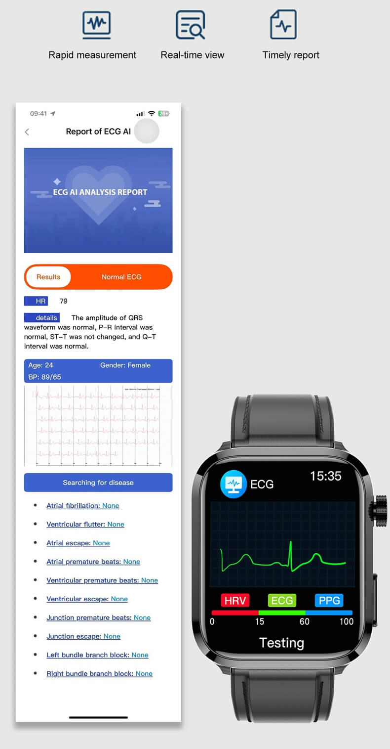 EKG-Messung