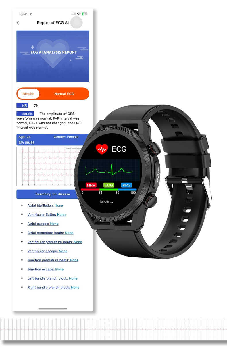 Hochpräzise EKG-Messung