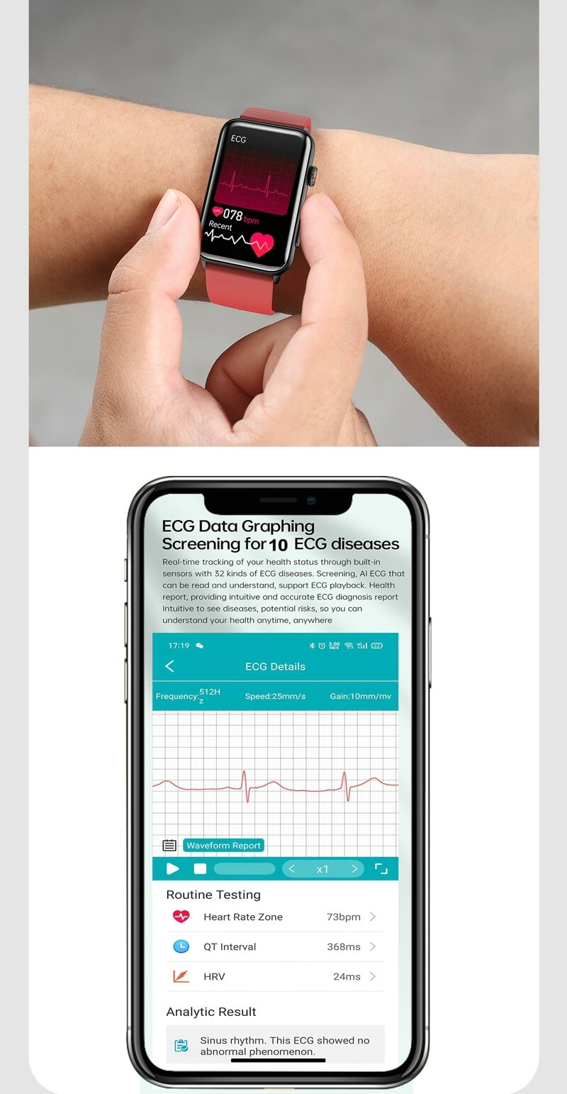 ECG Monitoring