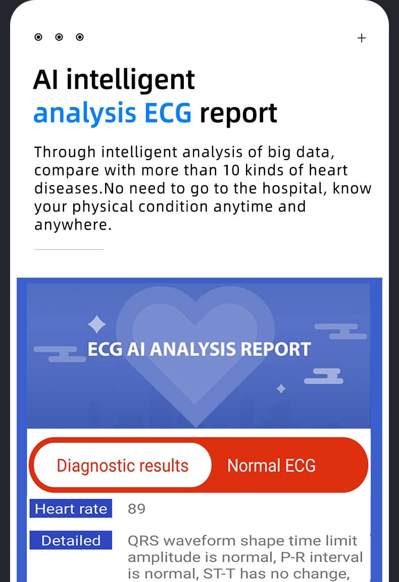 Findtime EKG-Smartwatch zur Überwachung des Blutdrucks, des Blutsauerstoffs, der Herzfrequenz und der Körpertemperatur