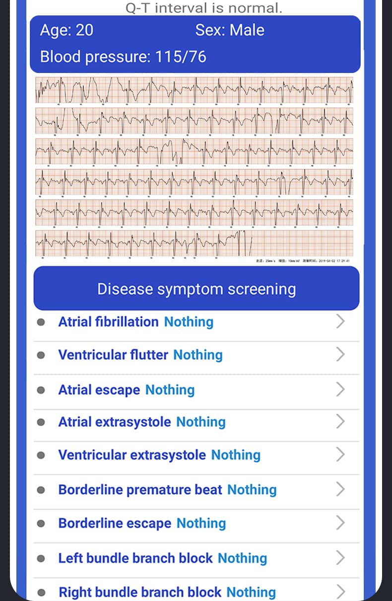 Findtime ECG Reloj inteligente Monitor Presión arterial Oxígeno sanguíneo Frecuencia cardíaca Temperatura corporal