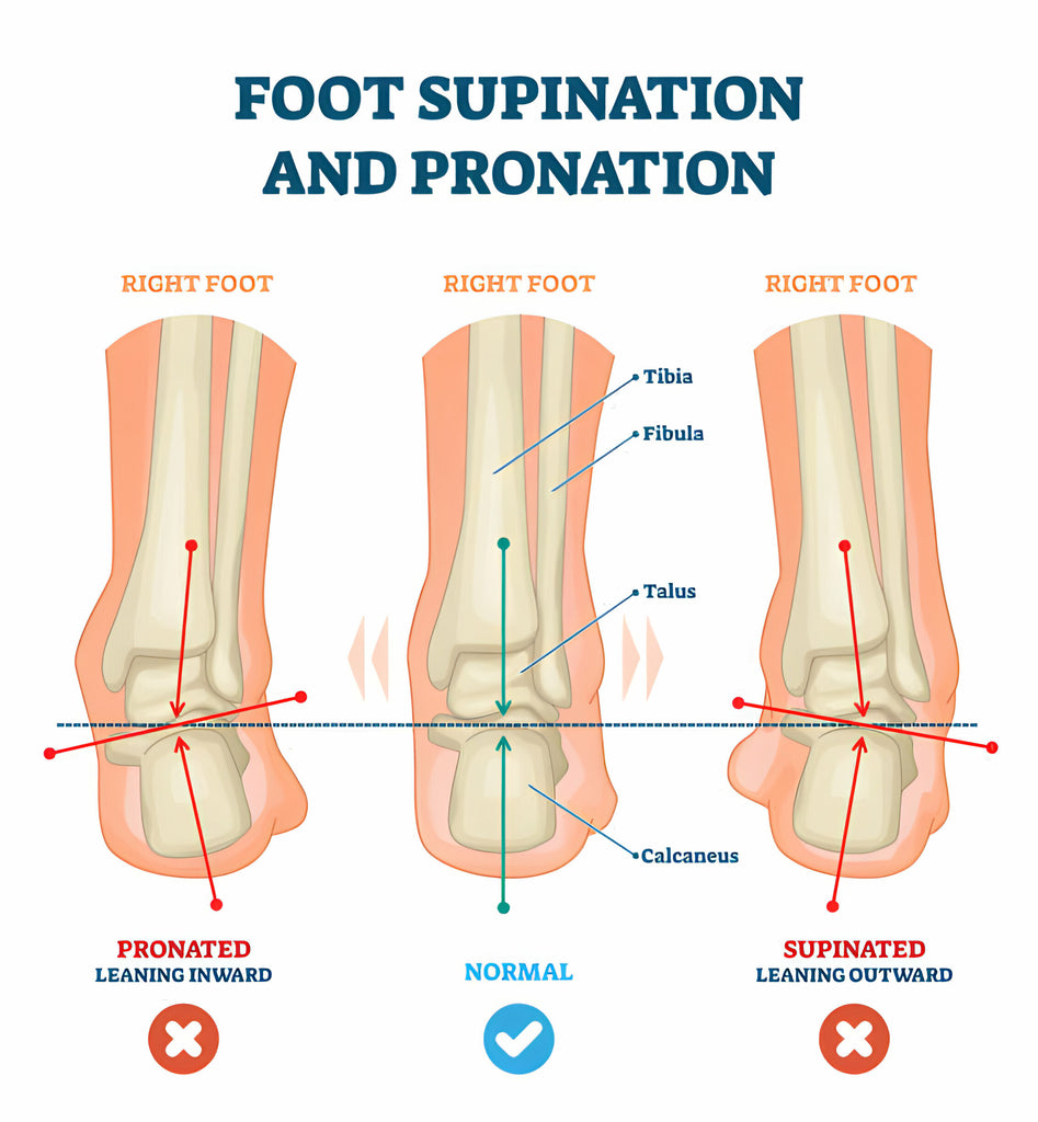 orthosis pronation