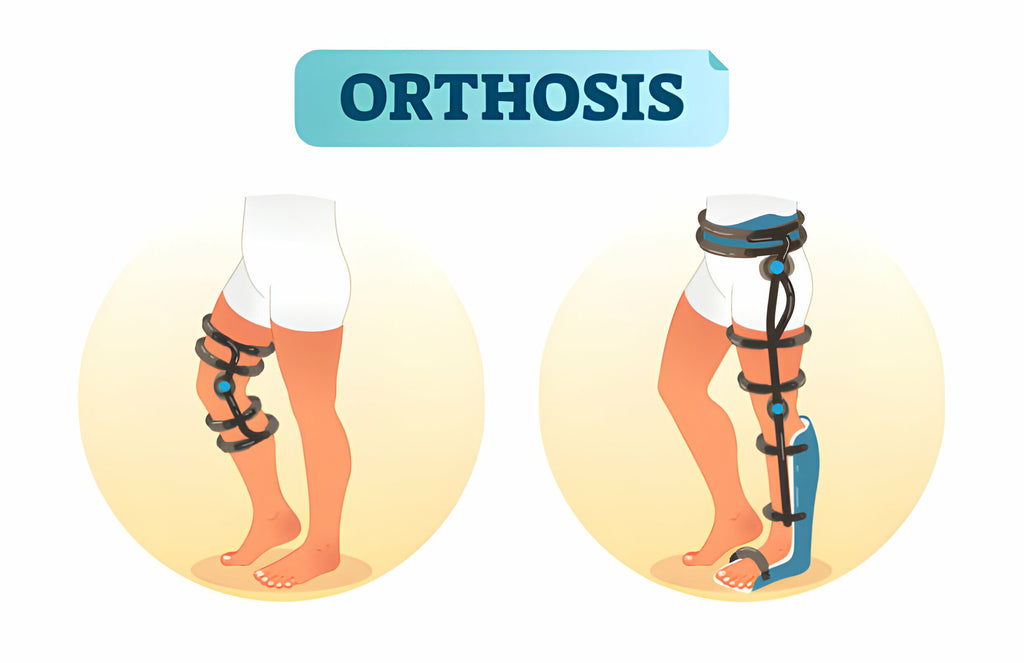 orthosis support