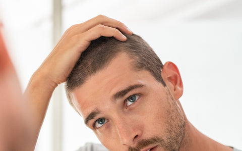 vitamin deficiency causes hair loss