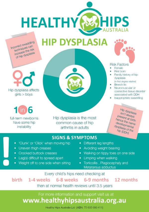 hip dysplasia infographic