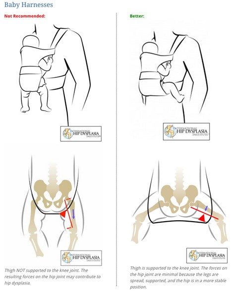 correct hip position in baby carriers