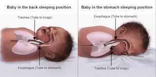 baby's airway on back vs front