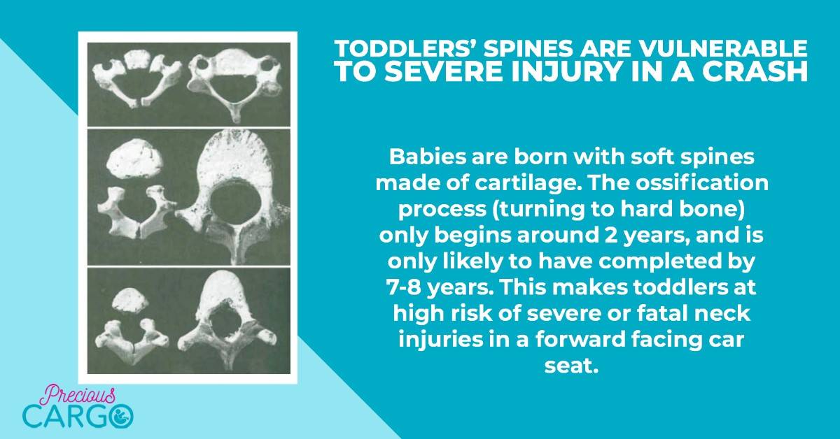 a toddler's spine is soft and at risk of injury in a crash