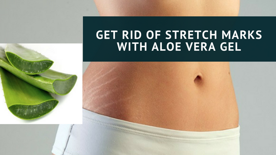 Get Rid of Stretch Marks with Aloe Vera Gel | The Aloe Skincare Company