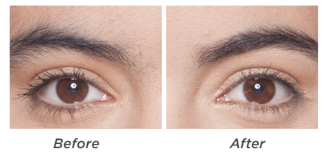 Quick Eyebrow Hair Remover - supdealshop