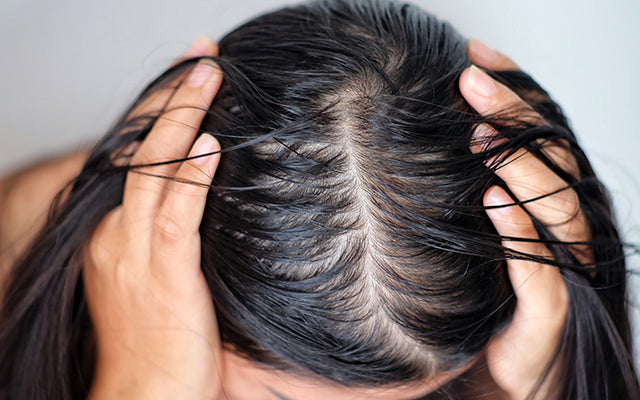 Degrease Shampoo for Oily Hair Care  Clarifying  Ubuy Nepal