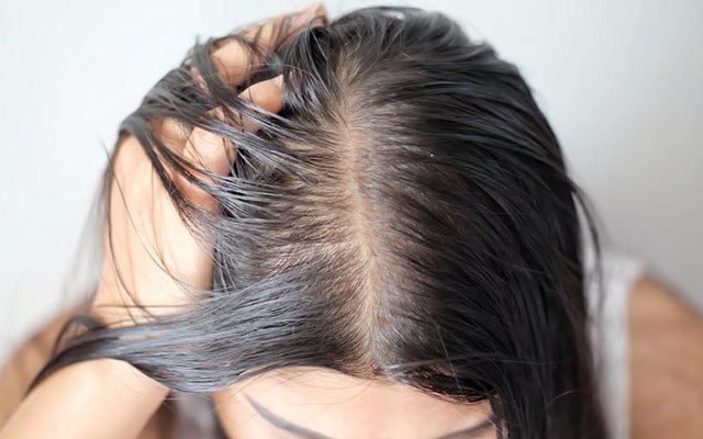 Greasy Hair Solutions You Should Try Right Away Skinkraft 
