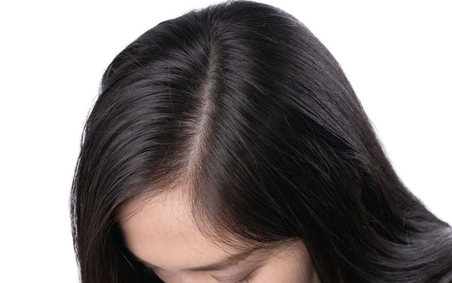 How to get rid of oily hair naturally Washing tips and more